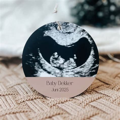 Een kerstbal met daarin een echofoto, of een Sinterklaasgedicht met verwijzingen naar een baby.