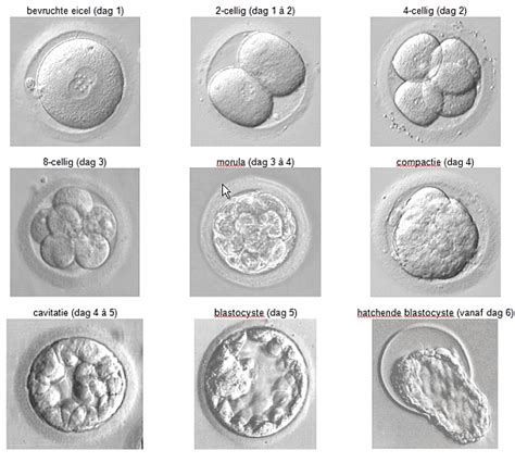 Illustratie van de verschillende stadia van embryo-ontwikkeling in het laboratorium, van dag 1 tot dag 5 (blastocyst).