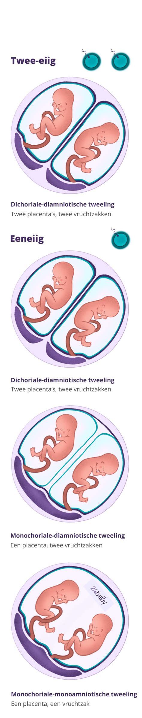 Illustratie die het verschil toont tussen de vorming van een eeneiige en een twee-eiige tweeling.