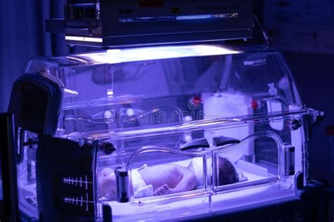 Een pasgeboren baby onder een speciale lamp voor de behandeling van geelzucht
