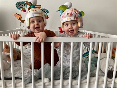 Illustratie van een baby met een afgeplat hoofdje om de ernst van de aandoening te tonen.