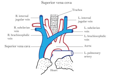 Diagram dat de juiste zijligging toont om het vena cava syndroom te voorkomen