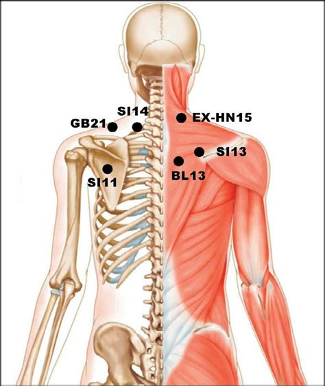acupuncture points for miscarriage