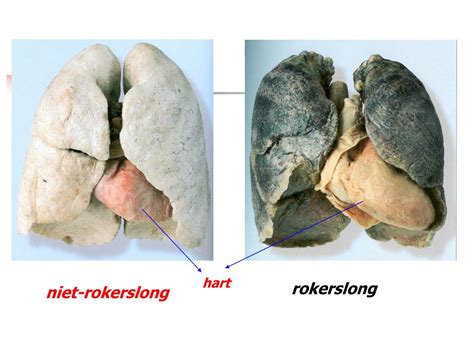 Vergelijking van vruchtbaarheidskansen voor rokers en niet-rokers