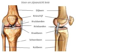 Schematische weergave van een kniegewricht met kraakbeenschade