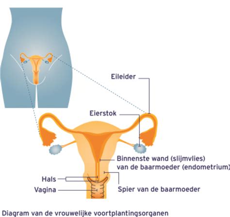 Illustratie van de dilatatie van de baarmoederhals met dilatatoren.