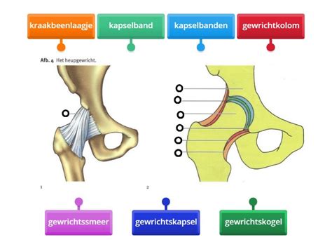 Illustratie van een normaal heupgewricht versus een heupgewricht met dysplasie, met focus op de aansluiting van de heupkop en heupkom.