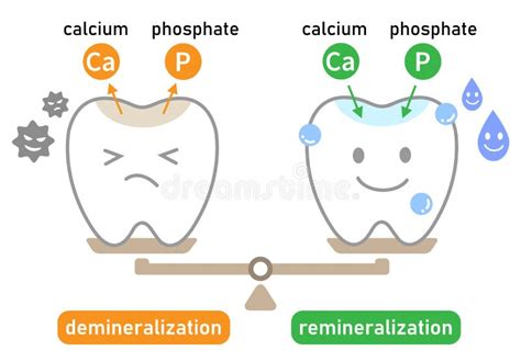 Schema dat het proces van demineralisatie en remineralisatie van tandglazuur onder invloed van zuuraanvallen illustreert.
