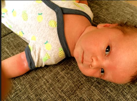 baby met rode billetjes die verzorgd worden met een zacht babydoekje