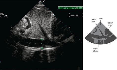 Echobeeld van een drachtig veulen rond 60 dagen